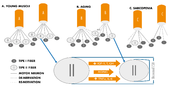 sarcopenia fibras rapidas